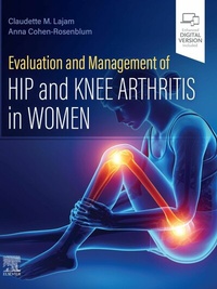 Abbildung von: Evaluation and Management of Hip and Knee Arthritis in Women - Elsevier