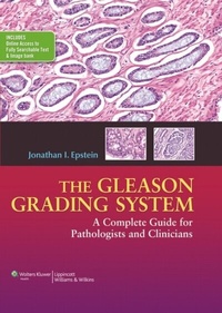 Abbildung von: Gleason Grading System - WOLTERS KLUWER HEALTH