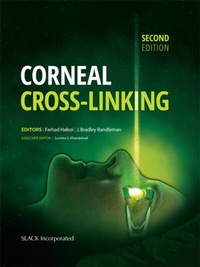 Abbildung von: Corneal Cross-Linking, Second Edition - Slack