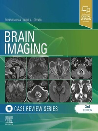 Abbildung von: Brain Imaging: Case Review Series E-Book - Mosby