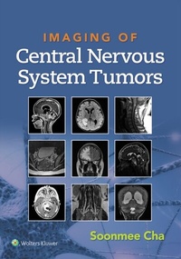 Abbildung von: Imaging of Central Nervous System Tumors - Wolters Kluwer Health