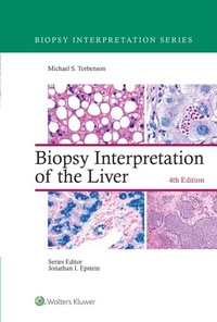 Abbildung von: Biopsy Interpretation of the Liver - Wolters Kluwer Health
