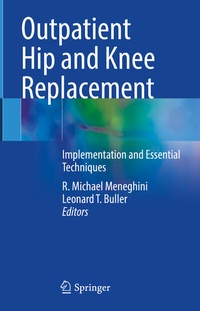 Abbildung von: Outpatient Hip and Knee Replacement - Springer