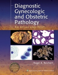 Abbildung von: Diagnostic Gynecologic and Obstetric Pathology - WOLTERS KLUWER HEALTH