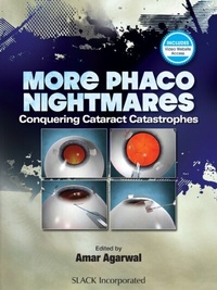 Abbildung von: More Phacoo Nightmares - SLACK Incorporated