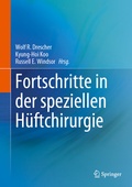 Cover: Fortschritte in der speziellen H&uuml;ftchirurgie - Springer
