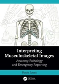 Cover: Interpreting Musculoskeletal Images - CRC Press