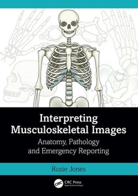 Enlarge image Cover: Interpreting Musculoskeletal Images - CRC Press