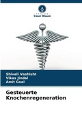 Cover: Gesteuerte Knochenregeneration - Verlag Unser Wissen