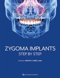 Abbildung von: Zygoma Implants - Quintessence Publishing Co, Inc
