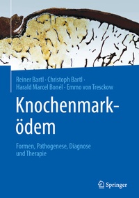 Abbildung von: Knochenmarködem - Springer