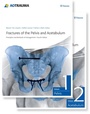Cover: Fractures of the Pelvis and Acetabulum (AO) - Thieme