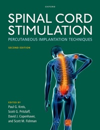 Enlarge image Cover: Spinal Cord Stimulation - Oxford University Press Inc