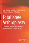 Cover: Total Knee Arthroplasty - Springer