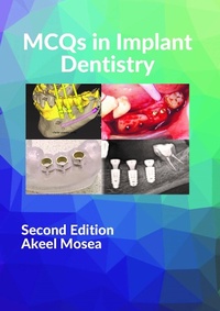 Abbildung von: MCQs in Implant Dentistry - Lulu.com
