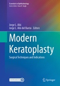 Cover: Modern Keratoplasty - Springer