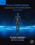 Abbildung von: Atlas of Hybrid Imaging Sectional Anatomy for PET/CT, PET/MRI and SPECT/CT Vol. 1: Brain and Neck - Academic Press
