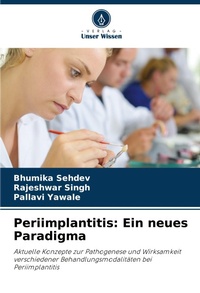 Enlarge image Cover: Periimplantitis - International Book Market Service Ltd