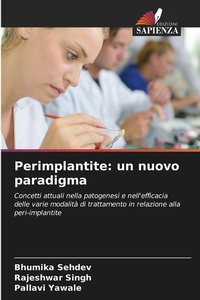 Enlarge image Cover: Perimplantite - International Book Market Service Ltd