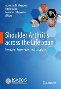 Abbildung von: Shoulder Arthritis across the Life Span - Springer