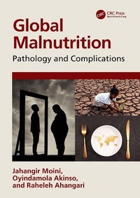 Abbildung von: Global Malnutrition - CRC Press