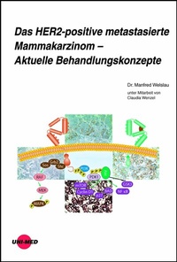 Abbildung von: Das HER2-positive metastasierte Mammakarzinom - Aktuelle Behandlungskonzepte - UNI-MED Verlag AG