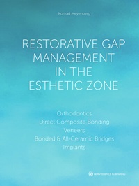 Abbildung von: Restorative Gap Management in the Esthetic Zone - Quintessenz Verlag