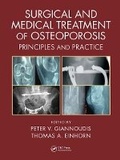 Cover: Surgical and Medical Treatment of Osteoporosis - CRC Press