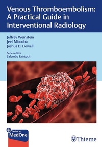 Abbildung von: Venous Thromboembolism - Thieme Publishers