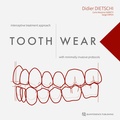 Cover: Tooth Wear - Quintessence Publishing Co. Ltd.