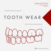 Abbildung von: Tooth Wear - Quintessence Publishing Co. Ltd.