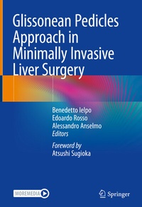 Abbildung von: Glissonean Pedicles Approach in Minimally Invasive Liver Surgery - Springer