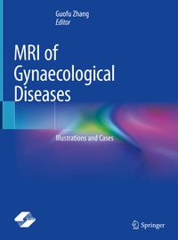 Abbildung von: MRI of Gynaecological Diseases - Springer
