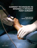 Cover: Current Techniques in Minimally Invasive Foot Surgery - InterAlpes