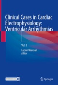 Bild: Clinical Cases in Cardiac Electrophysiology: Ventricular Arrhythmias - Springer