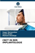 Cover: Cbct in Der Implantologie - Verlag Unser Wissen