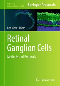 Abbildung von: Retinal Ganglion Cells - Humana
