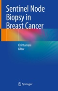 Cover: Sentinel Node Biopsy in Breast Cancer - Springer