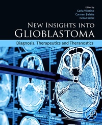 Abbildung von: New Insights into Glioblastoma - Academic Press