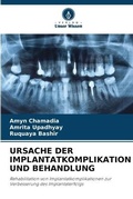Cover: Ursache Der Implantatkomplikation Und Behandlung - Verlag Unser Wissen