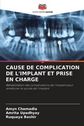 Cover: Cause de Complication de l'Implant Et Prise En Charge - Editions Notre Savoir