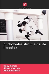Enlarge image Cover: Endodontia Minimamente Invasiva - Edicoes Nosso Conhecimento
