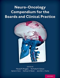 Abbildung von: Neuro-Oncology Compendium for the Boards and Clinical Practice - OUP eBook