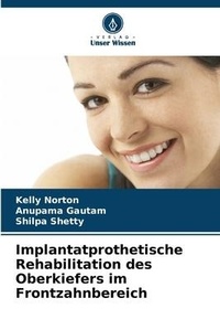 Abbildung von: Implantatprothetische Rehabilitation des Oberkiefers im Frontzahnbereich - Verlag Unser Wissen