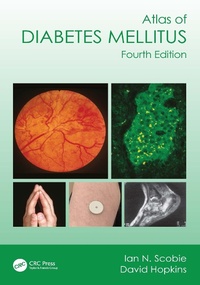 Abbildung von: Atlas of Diabetes Mellitus - CRC Press