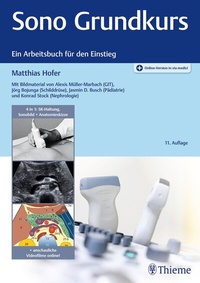 Abbildung von: Sono Grundkurs - Thieme