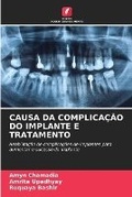 Cover: Causa Da Complicacao Do Implante E Tratamento - Edicoes Nosso Conhecimento