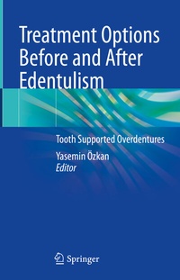 Abbildung von: Treatment Options Before and After Edentulism - Springer