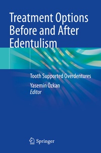 Abbildung von: Treatment Options Before and After Edentulism - Springer