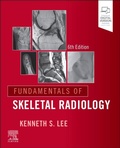 Cover: Fundamentals of Skeletal Radiology - Churchill Livingstone